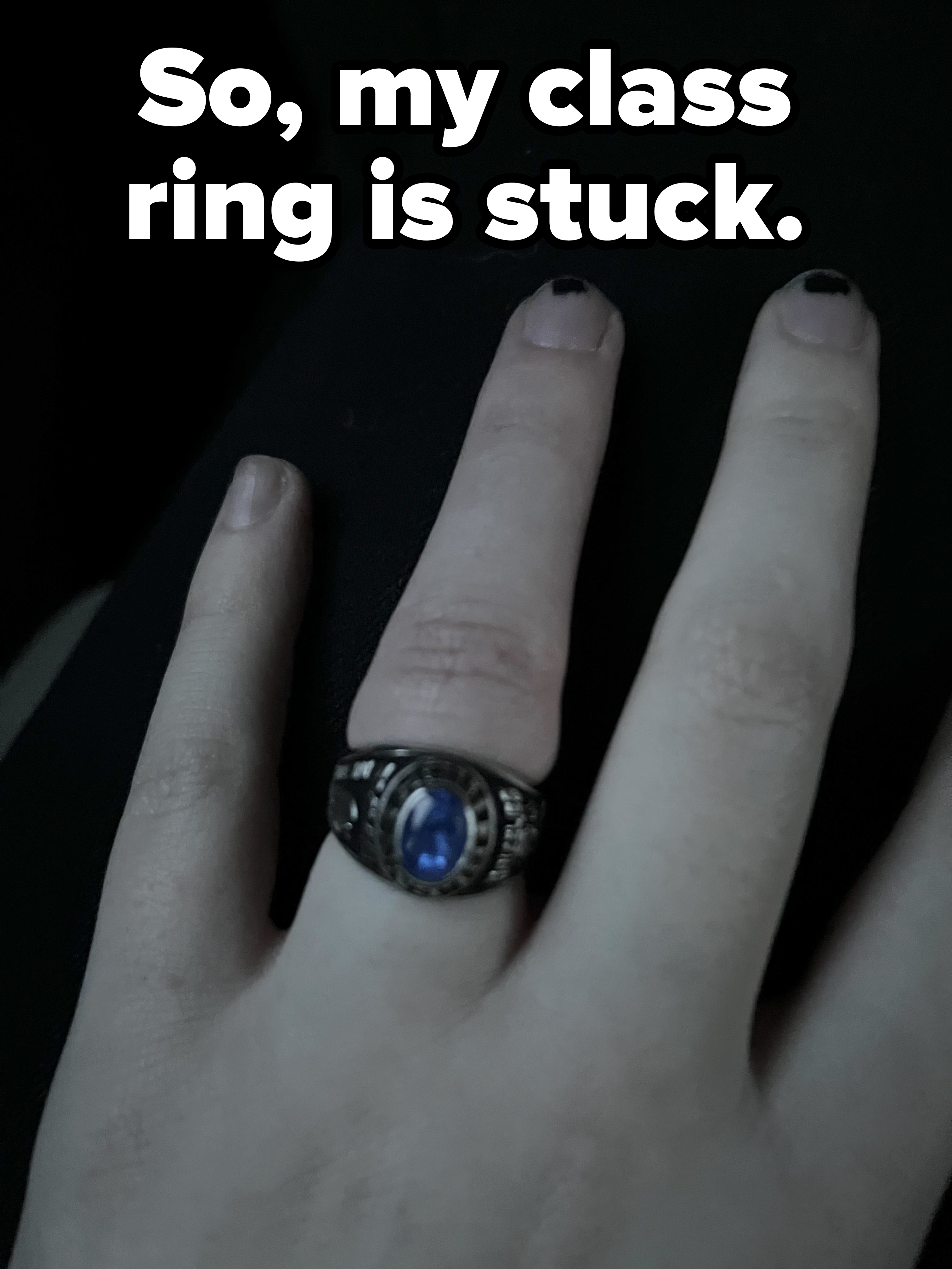 Close-up of a hand with a finger wearing a class ring with a large blue stone that looks very tight, with caption &quot;So, my class ring is stuck&quot;