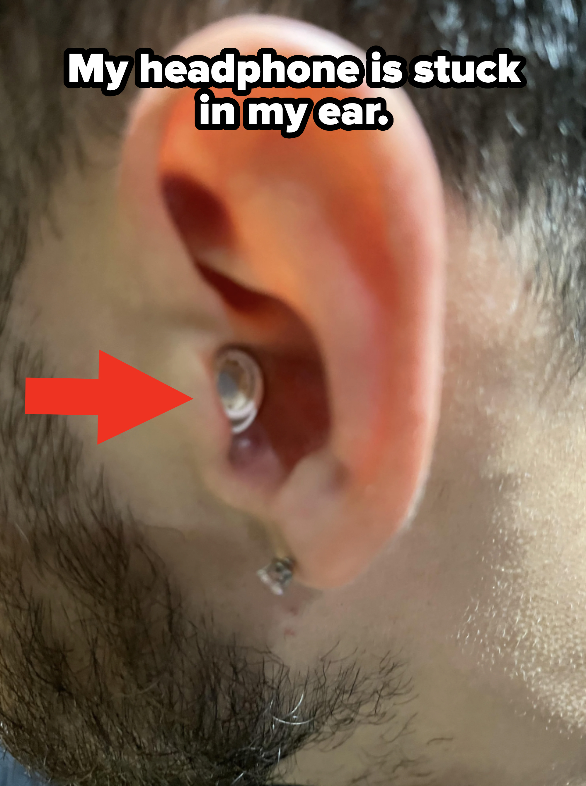 Close-up of a person&#x27;s ear with an earbud deep inside, with caption &quot;My headphone is stuck in my ear&quot;