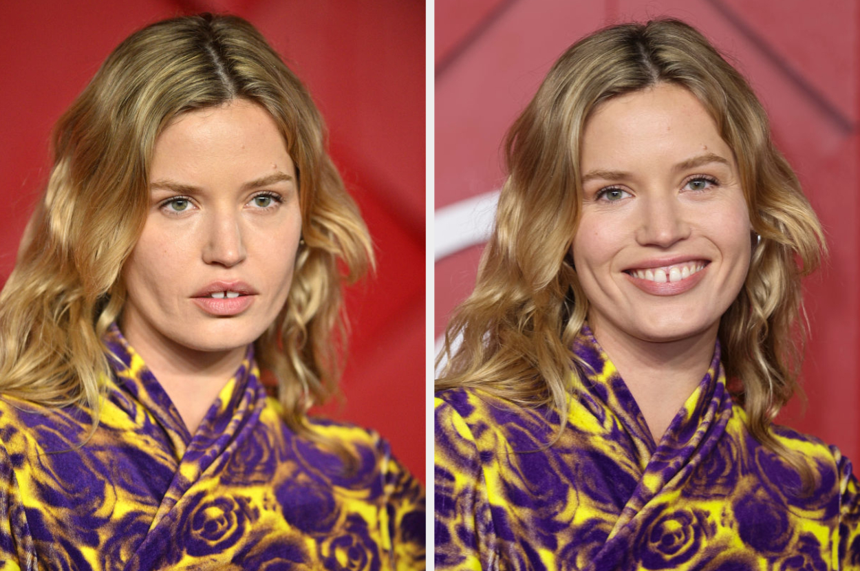 Two side-by-side photos of the same person wearing a patterned top, smiling in the right photo