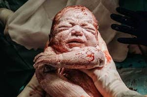 Newborn baby covered in vernix held by gloved hands, immediately after birth