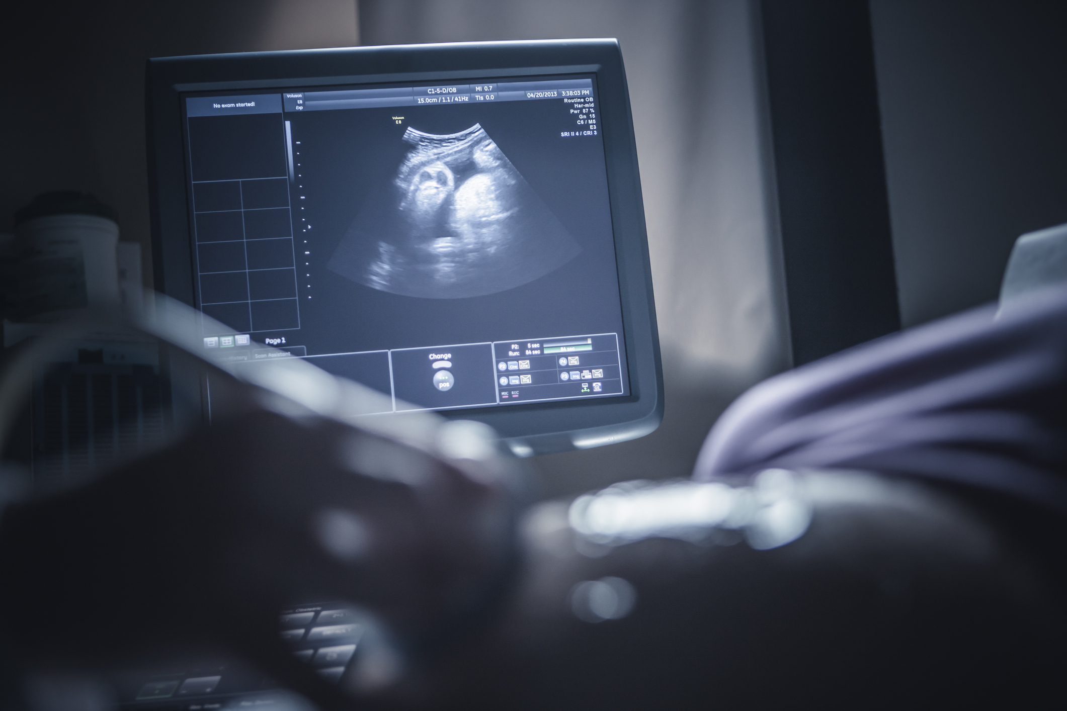 Ultrasound screen showing a fetus with a healthcare professional&#x27;s hand in the foreground