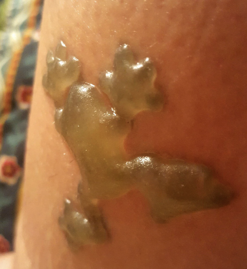 A close-up of a gummy bear melted onto a person&#x27;s skin
