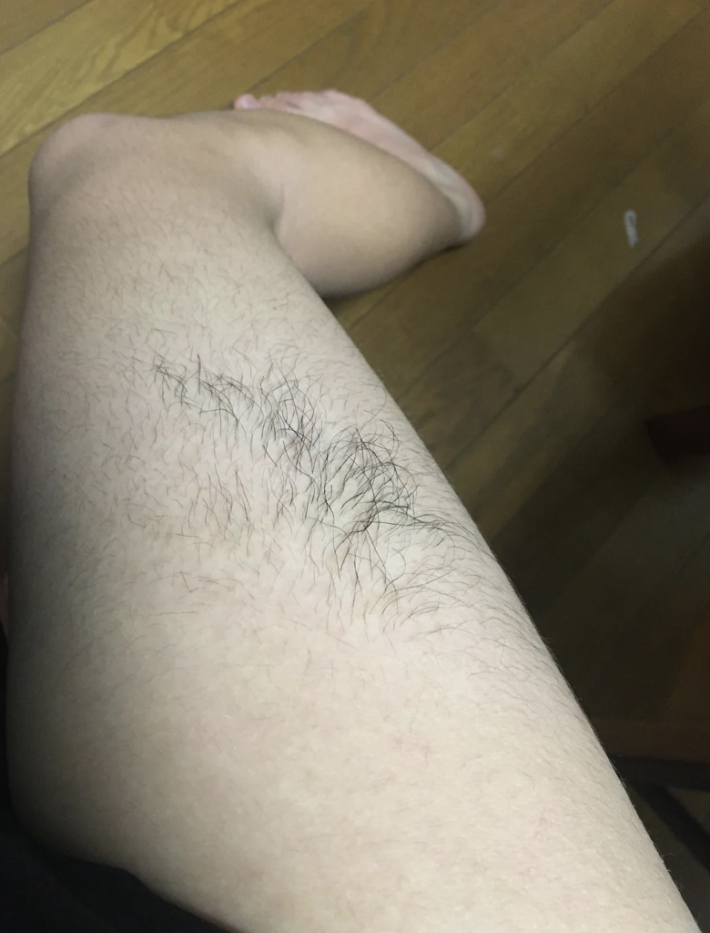 Close-up of a person&#x27;s leg showing hair growth