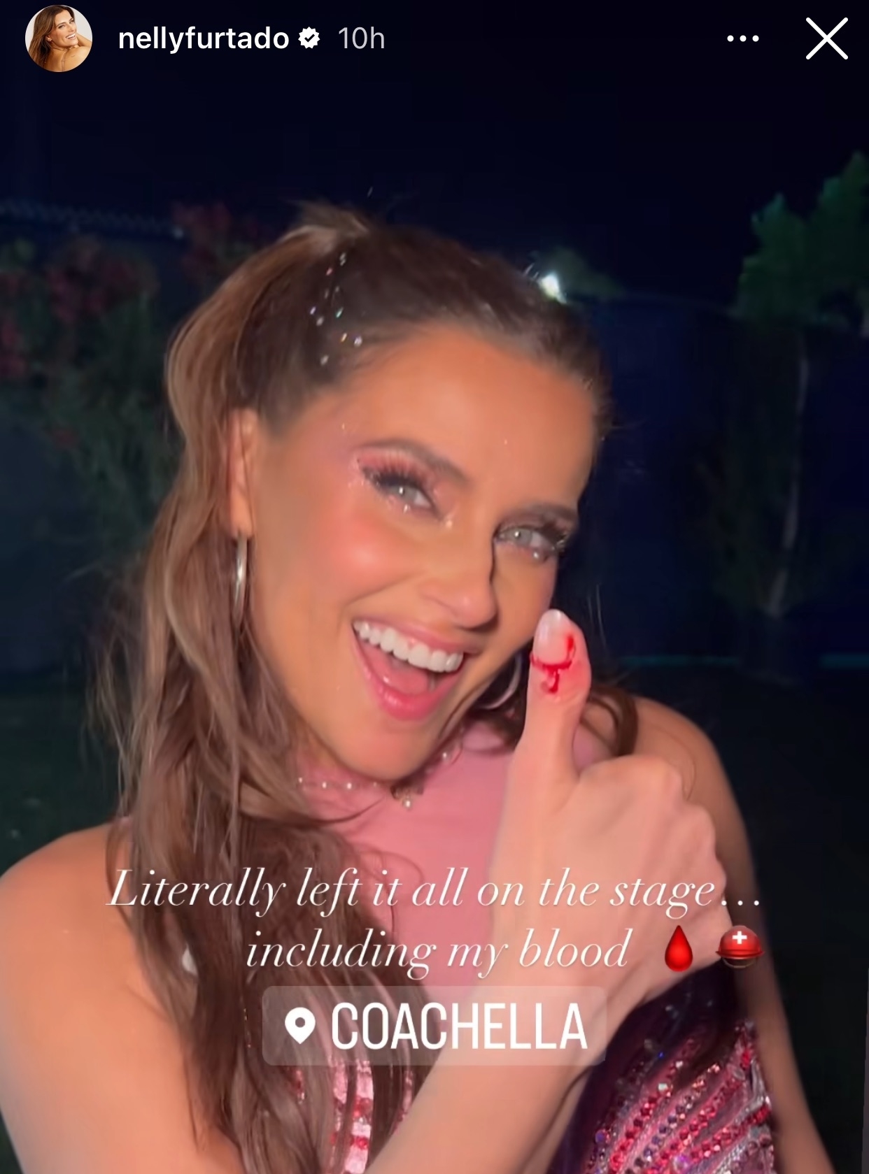 Nelly Furtado smiling with a thumbs-up, showing a small blood spot on her finger, text about a performance injury at Coachella