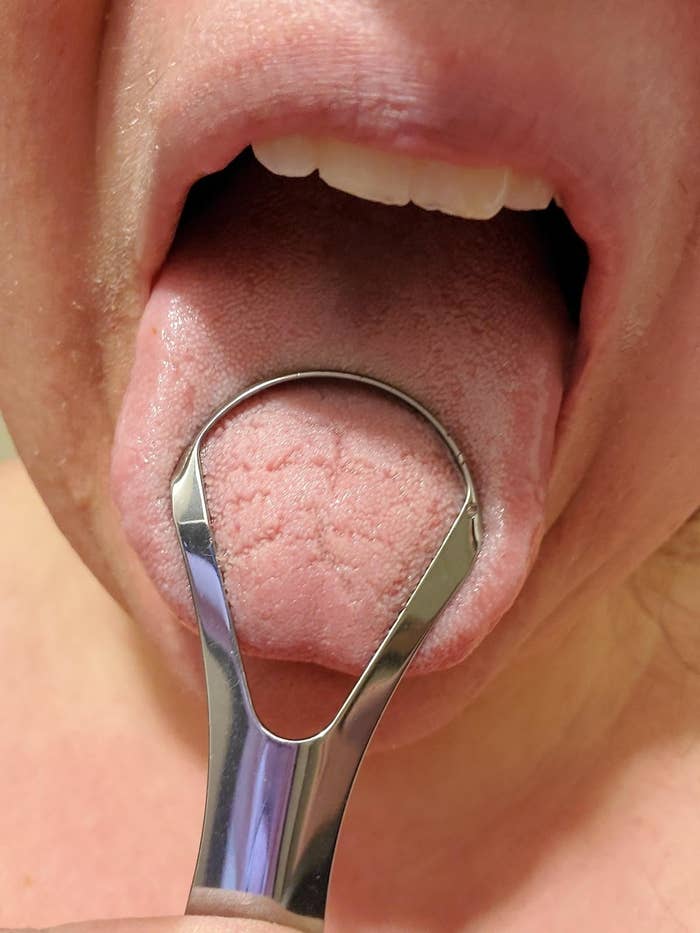 Reviewer using the tongue scraper on tongue