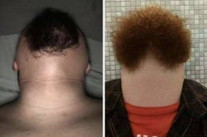 Two photos of a person with an unusual haircut resembling the neckline of a shirt, front and back views
