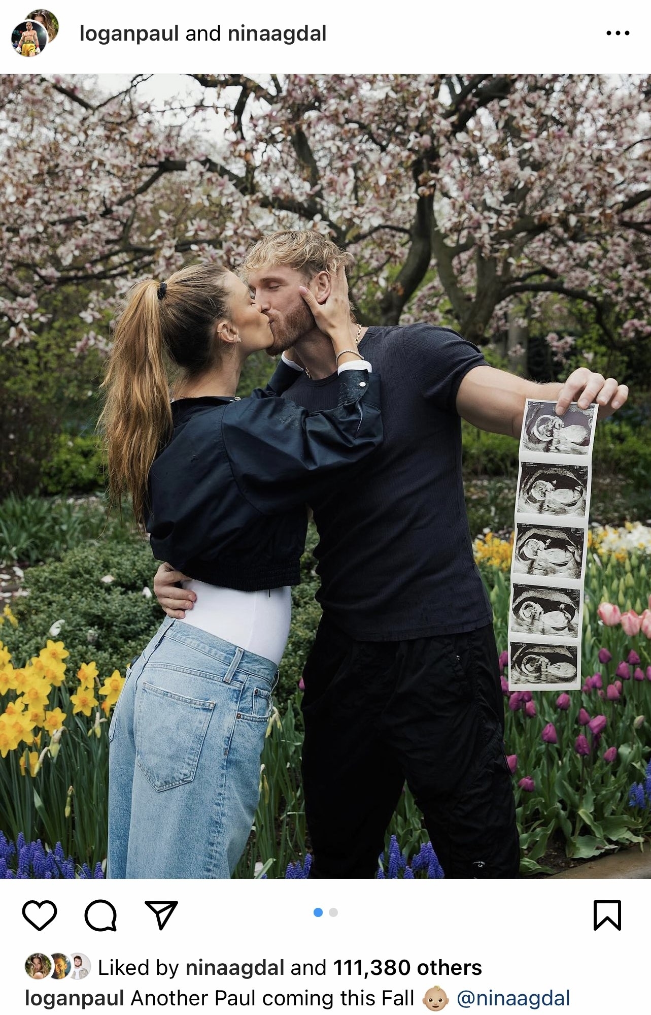 Logan Paul and Nina Agdal Are Having a Baby | Complex