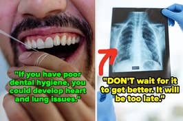 Person flossing teeth, and a hand holding a chest x-ray with health warning text