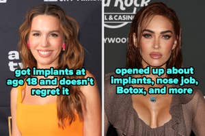 Celebrities discussing their implants, nose job, and Botox