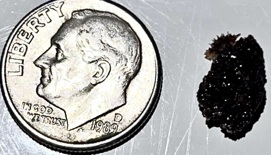 A quarter coin next to a small, irregular-shaped kidney stone to compare sizes