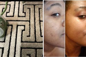 A collage of three images featuring a patterned carpet, and a person's before and after skincare results