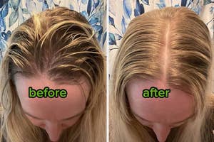 Top view of a person's head showing hair before and after a treatment. Text labels indicate 'before' and 'after' effects