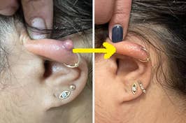 Person showing an ear before and after wearing an earring, highlighting the style for a shopping context