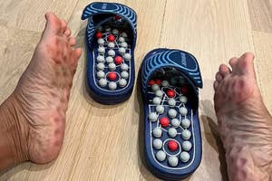 reviewer's feet on display besides acupressure flip flops