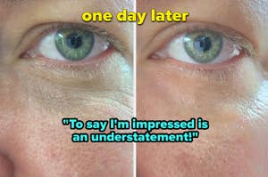 Before and after close-up of a reviewer's eyes showcasing the effects of the eye cream "one day later. to say I'm impressed is an understatement"