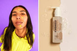 Model wearing star-shaped pimple patches on their face; bottle of Honest gel cleanser