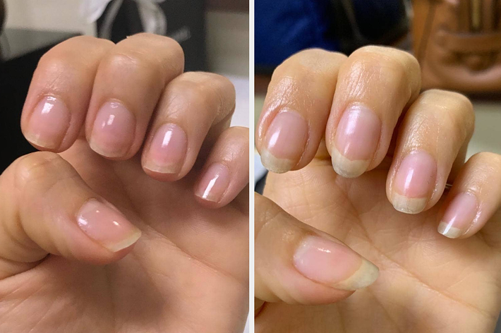 Two hands with natural manicured nails, one with clear polish and the other with French tips