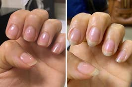 Two hands with natural manicured nails, one with clear polish and the other with French tips