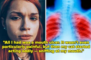 Composite image: left-side shows a teary-eyed woman; right-side displays an X-ray of lungs with a focus on the mouth area. Text overlay shares a quote about a mouth ulcer and a cat's strange reaction