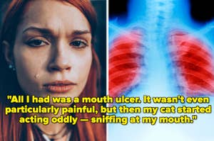 Composite image: left-side shows a teary-eyed woman; right-side displays an X-ray of lungs with a focus on the mouth area. Text overlay shares a quote about a mouth ulcer and a cat's strange reaction