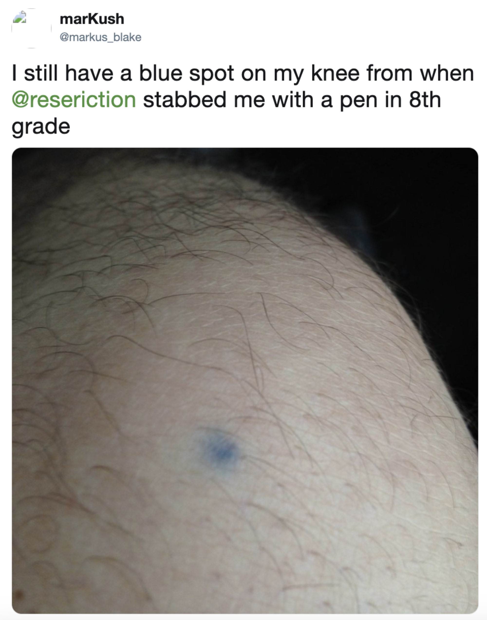 Close-up of a person&#x27;s knee with a small blue mark, captioned by the user recalling being stabbed with a pen in 8th grade