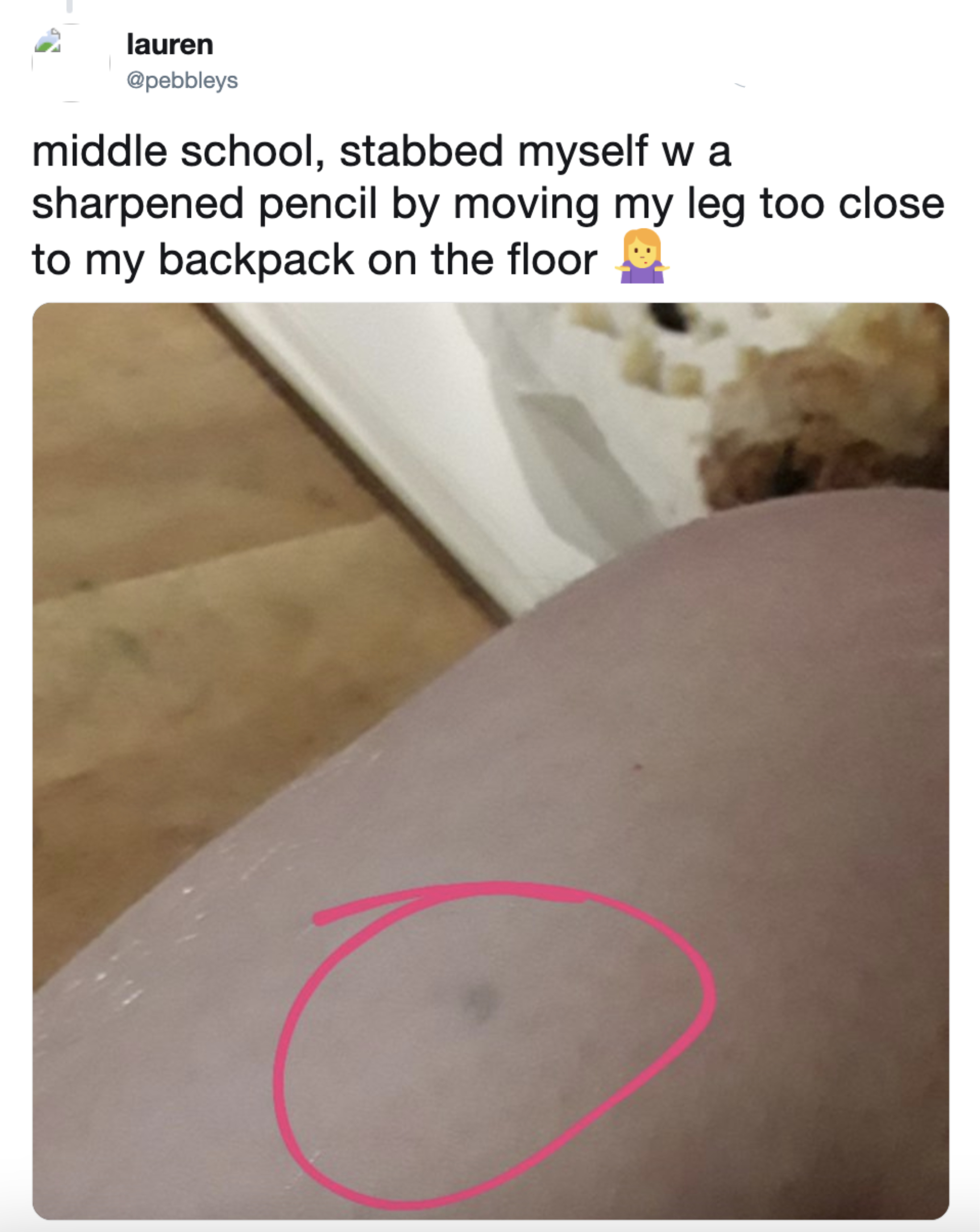 Person&#x27;s knee with a small mark circled in pink, likely indicating a minor injury. A tweet overlay describes a stubbing incident