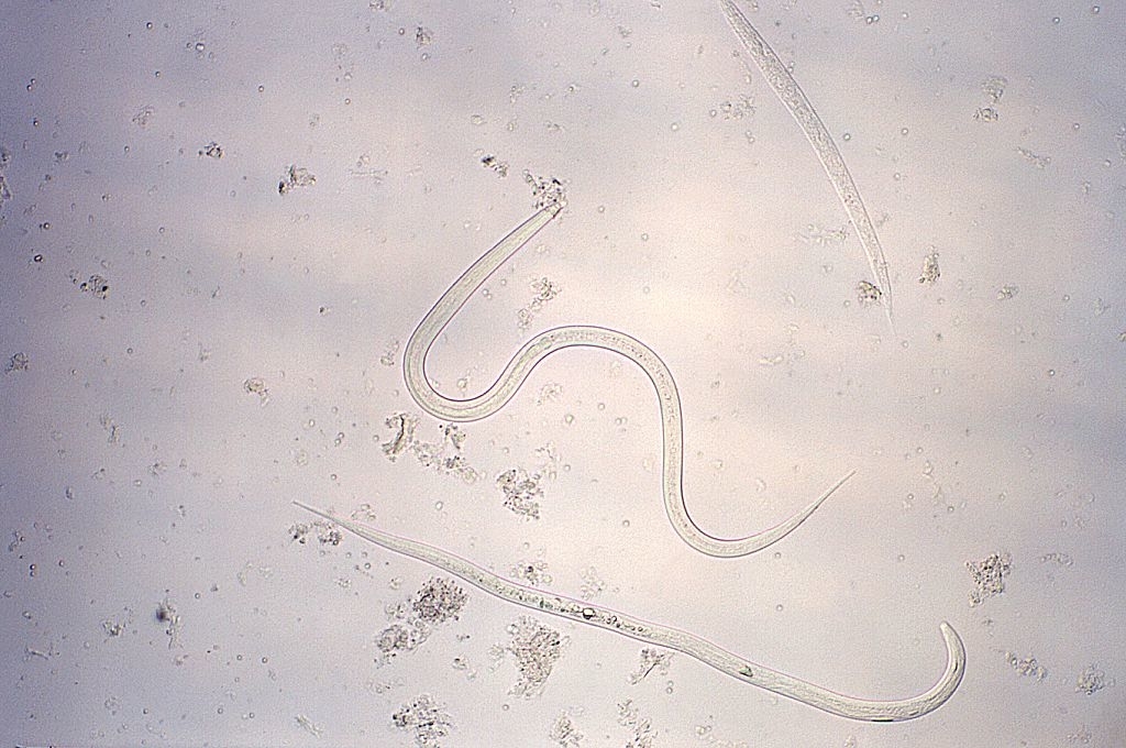 Microscopic view of transparent nematodes among small particles on a slide