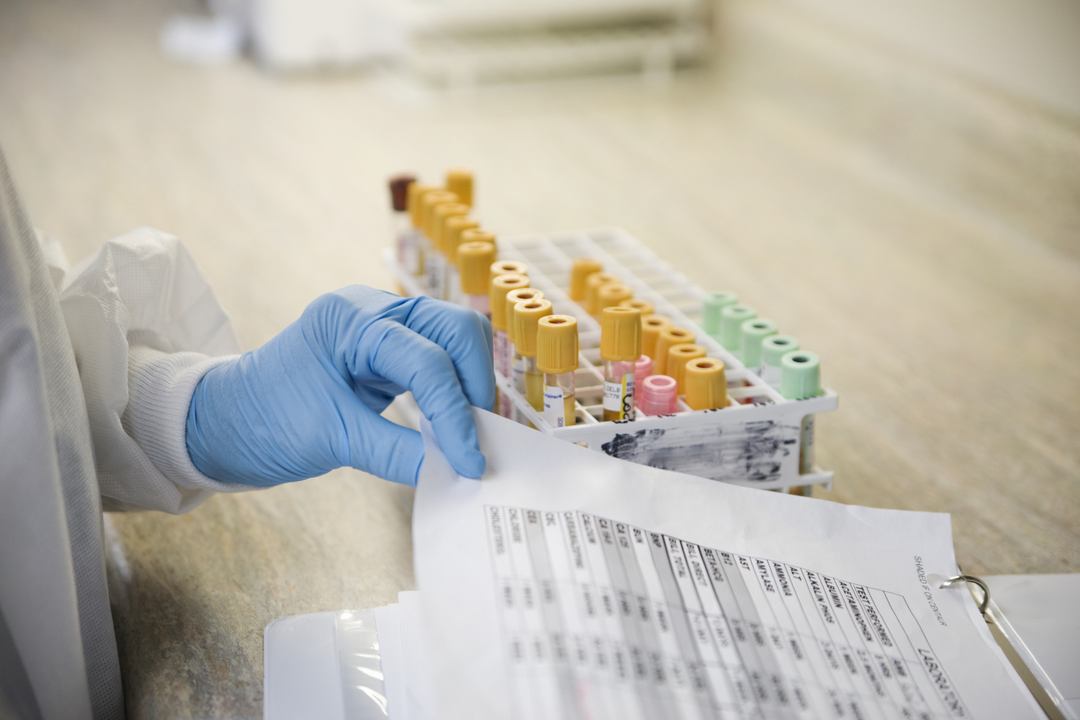 A medical professional&#x27;s gloved hand retrieving a sheet next to a rack of labeled test tubes