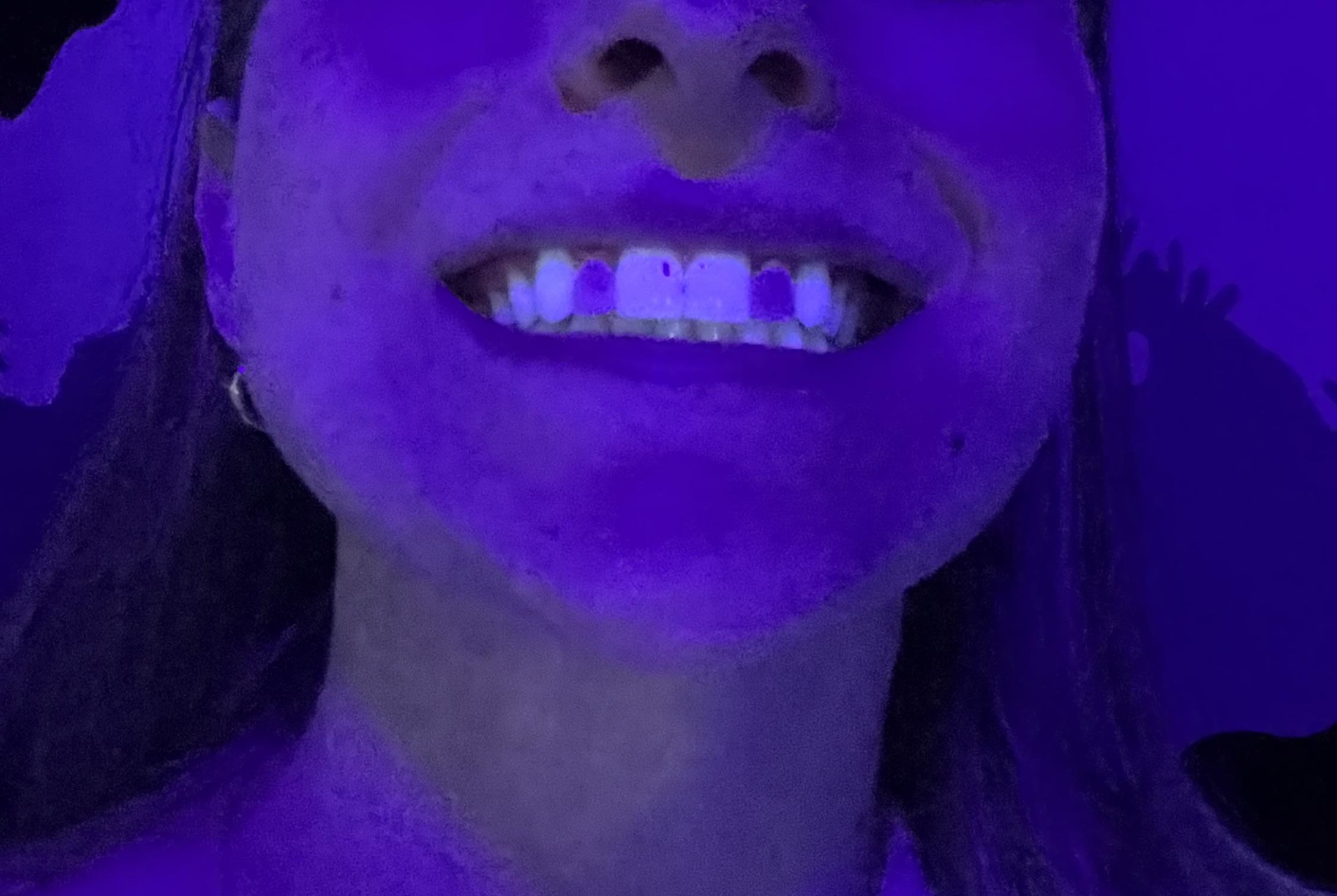 Close-up of a person&#x27;s smiling mouth under blue light