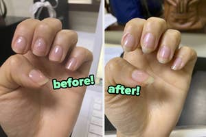 on left: reviewer's nails without much growth, on right: same reviewer's nails with some growth after using nail treatment