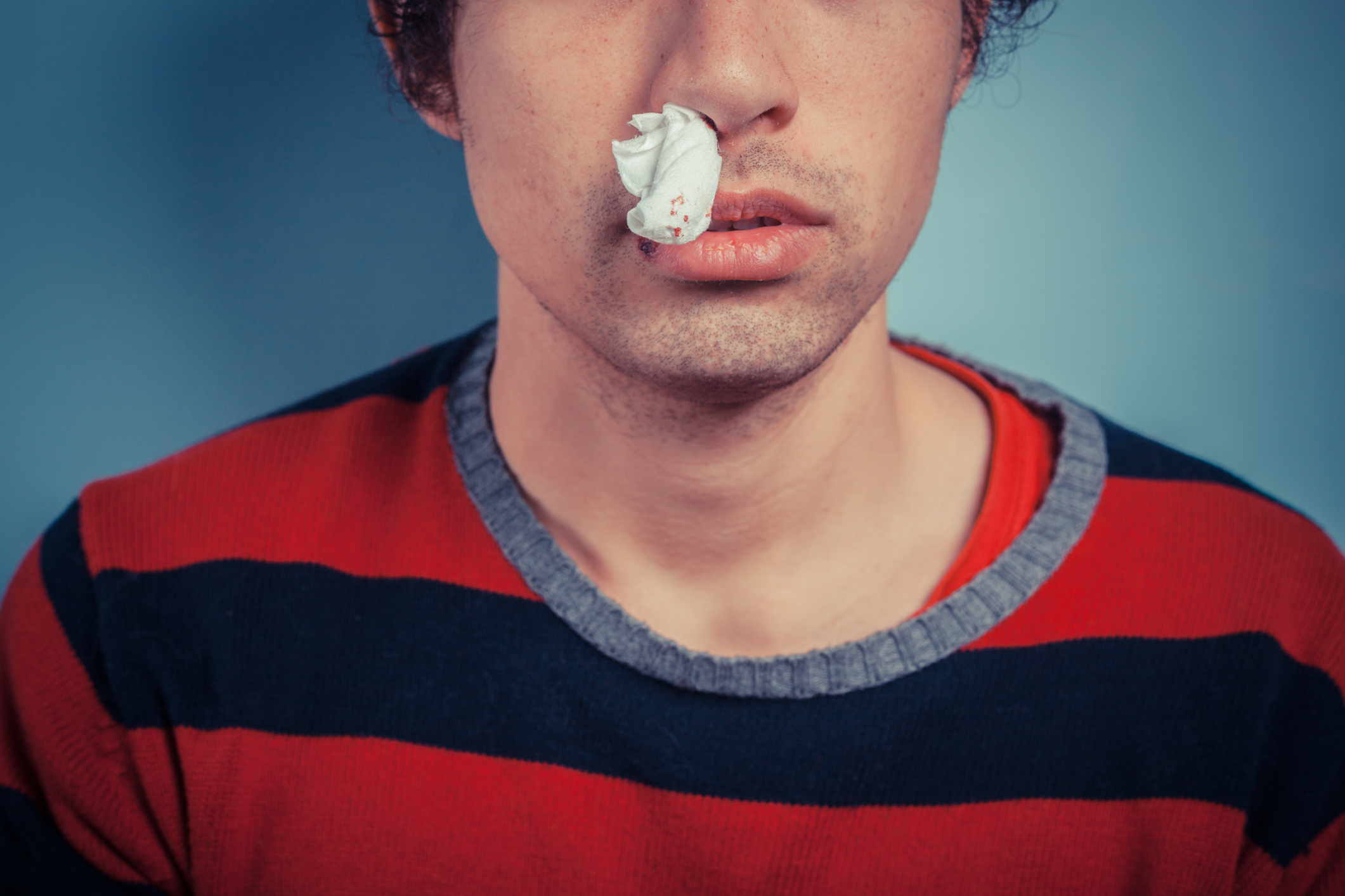 Person with tissue in their nose, indicating a nosebleed or nasal issue, wearing a striped shirt