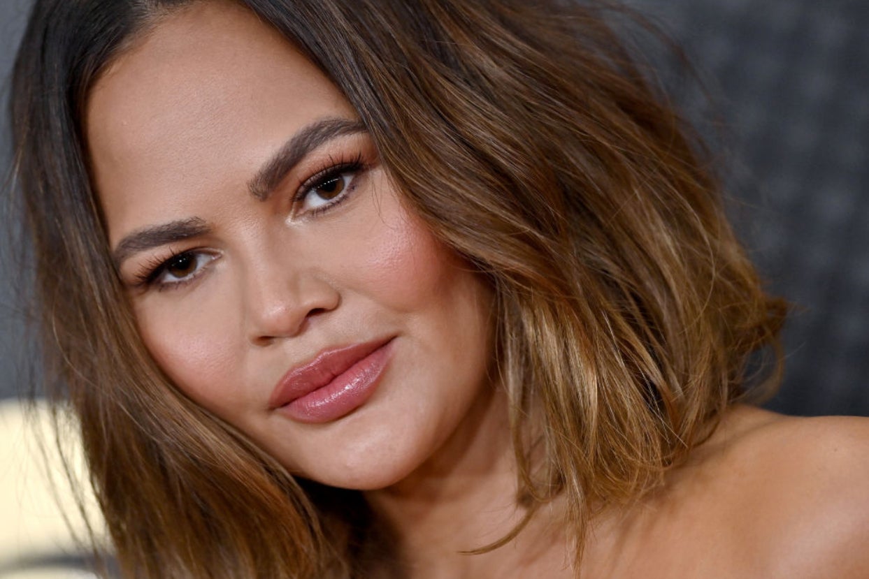 Chrissy Teigen Shared A Video Of The "Anxiety Hives" Across Her Chest On The Way To A Red Carpet Event