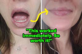 a reviewer's chapped lips before and after moisturized "this worked immediately. so worth it"