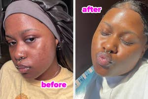 Before and after images of reviewer showcasing skincare results