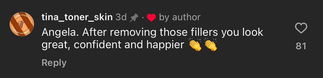 Comment on a social media post praising Angela for looking confident and happier after filler removal, includes clapping hands emoji