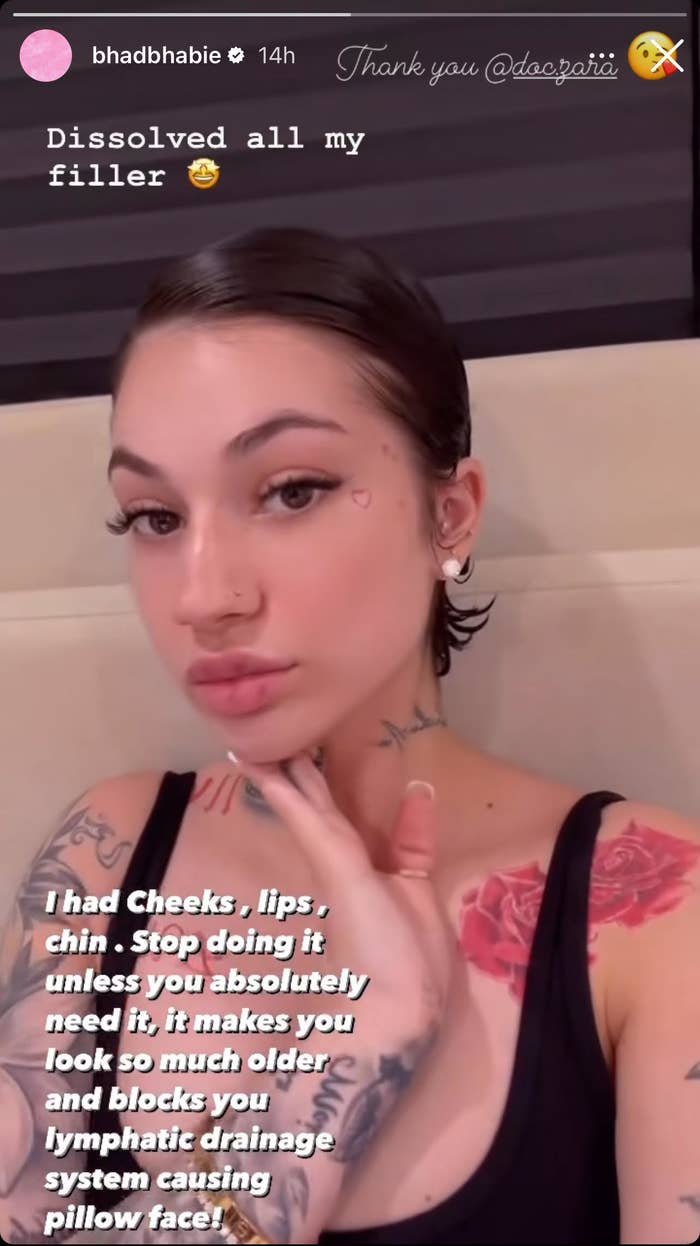Photo of Bhad Bhabie with hand on chin and text advising against chin fillers due to lymphatic drainage system issues