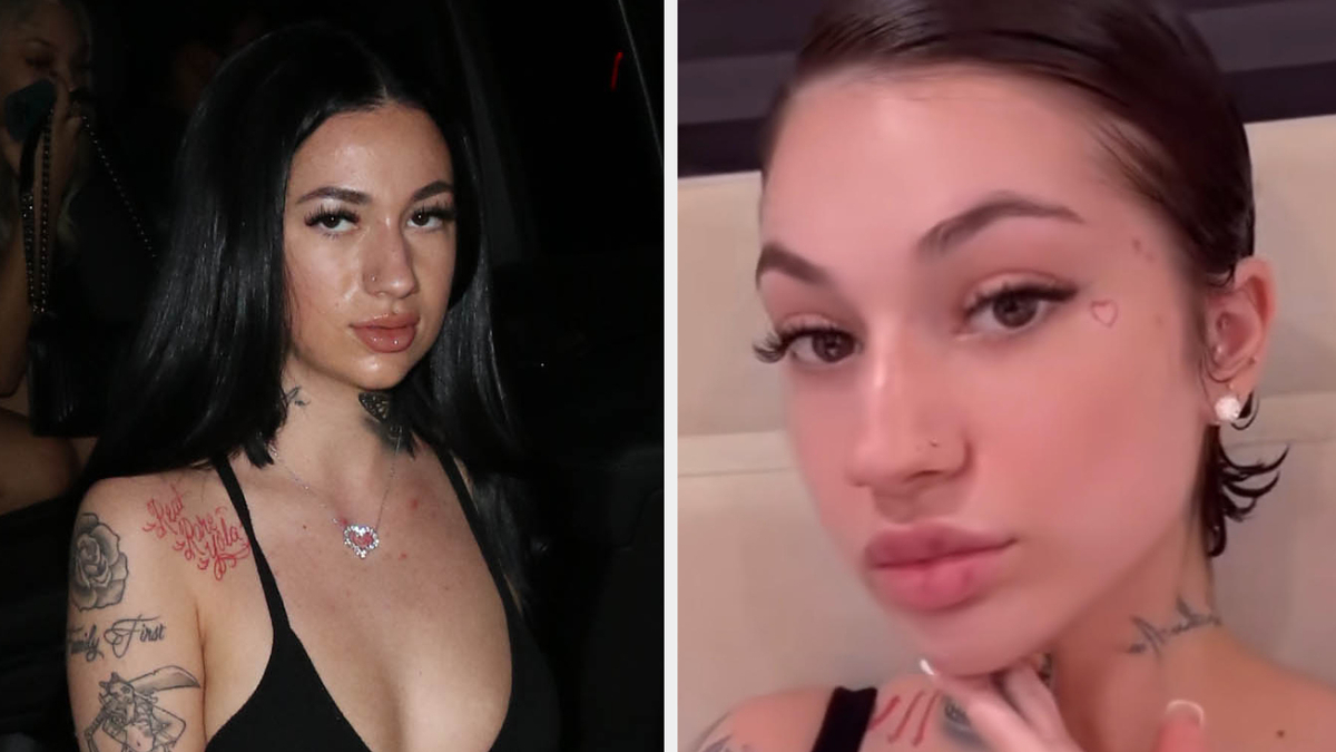 Bhad Bhabie Says She Dissolved Her Fillers: ‘Stop Doing It Unless You Absolutely Need It’