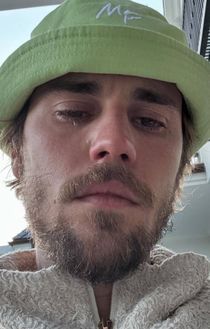 Closeup of Justin Bieber crying