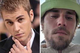 Justin Bieber in a suit on the left and in a casual outfit with a beanie on the right