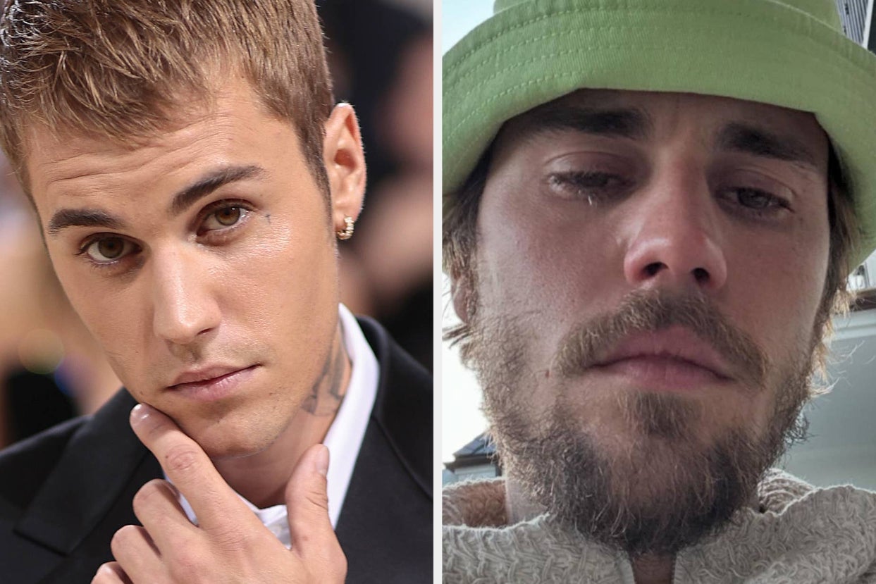 After Justin Bieber Posted Crying Selfies On Instagram, There's New Reports On His Mental Health