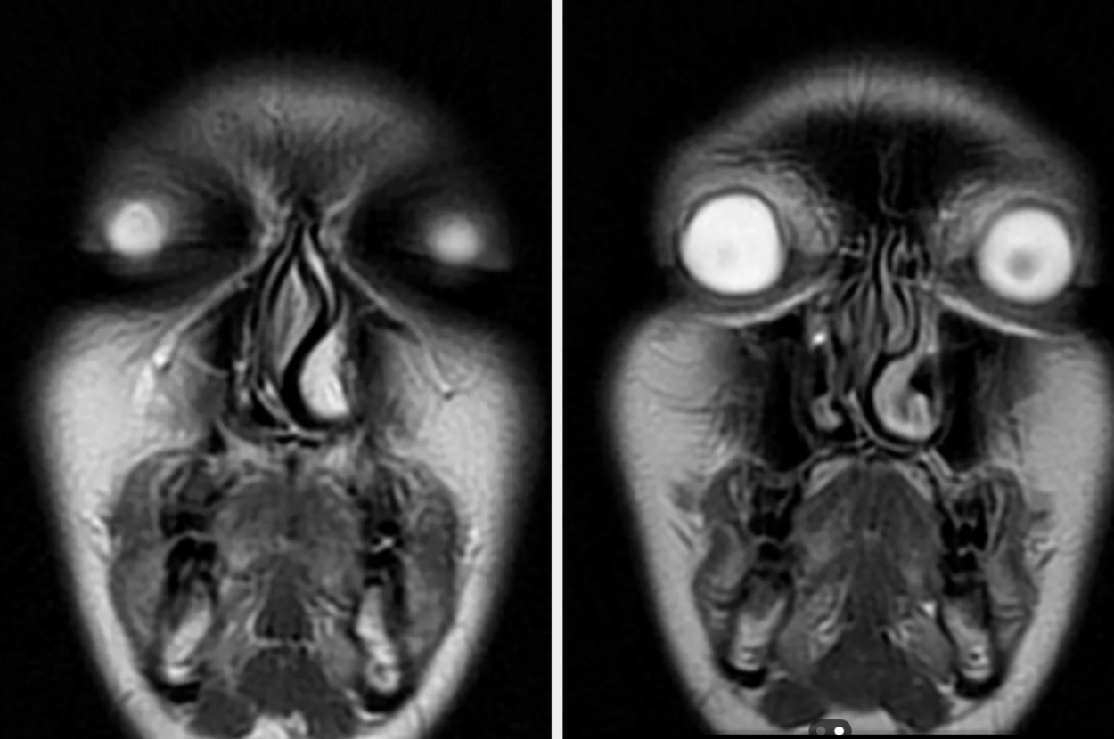 A mirrored medical MRI scan of a human face resembling a creepy mask
