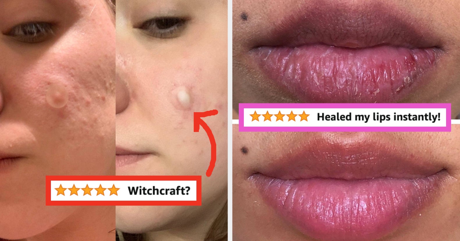 28 Products If You Want To Start A Skincare Routine And Don’t Know ...