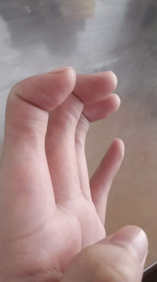 A hand without middle knuckles