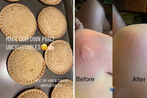 Two images side by side; left shows homemade PB&J sandwiches, right shows a before and after of a skin irritation