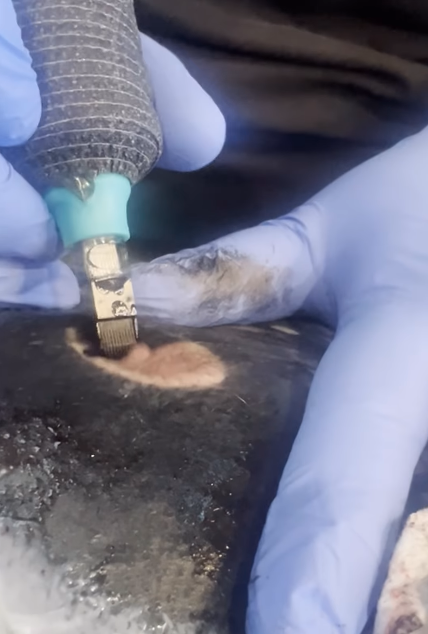 Hands in gloves shaving hair from a skin area with a medical clipper for a procedure