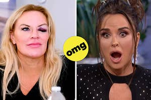 split frame of heather gaye with a black eye on real housewives of salt lake city and kyle richards reacting to shocking news on a reunion