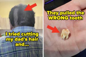 Two-part image: left shows a person with a poorly cut hairstyle; right shows a hand holding a removed tooth with caption about a dental mistake