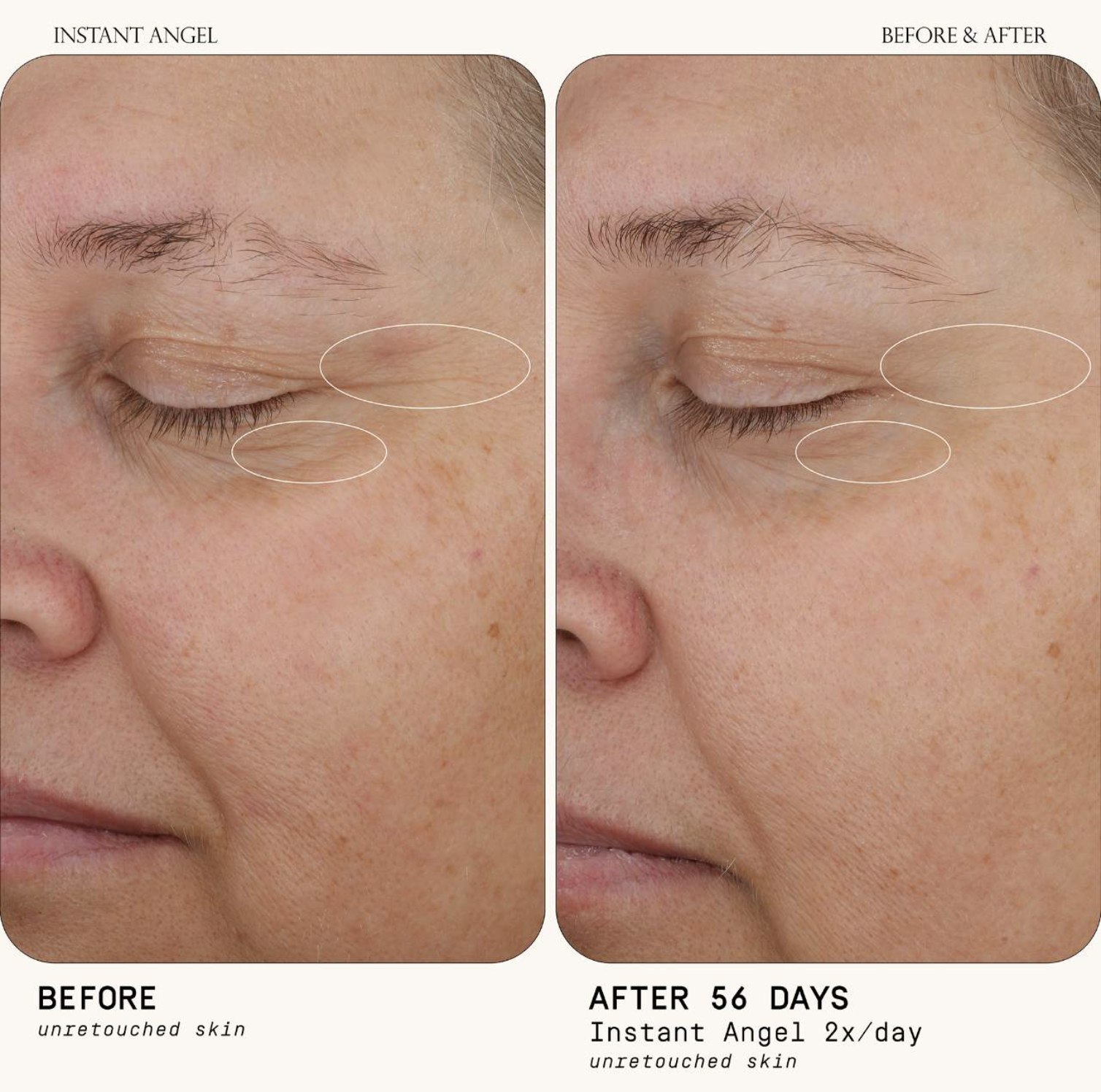 Close-up comparison of skin before and after 56 days using Instant Angel cream, showing visible improvement