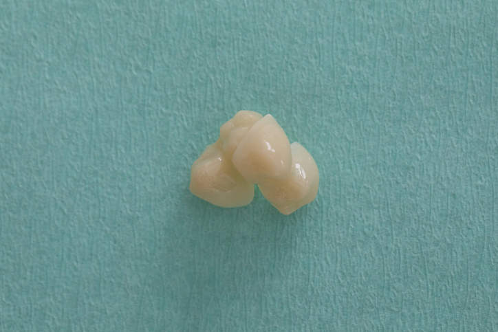 Dental crown on a textured surface