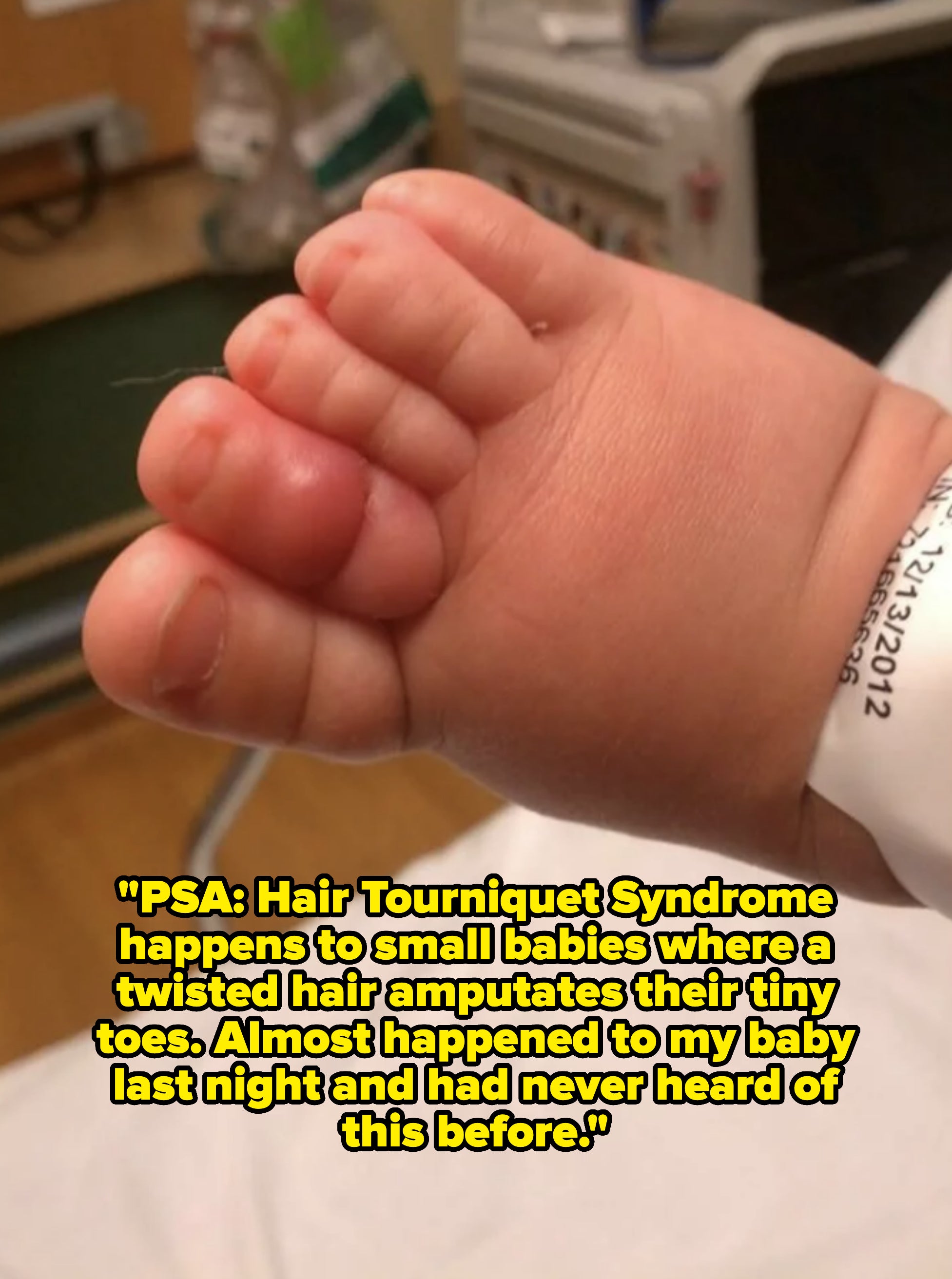Close-up of a baby&#x27;s foot held gently, hospital band visible on the wrist